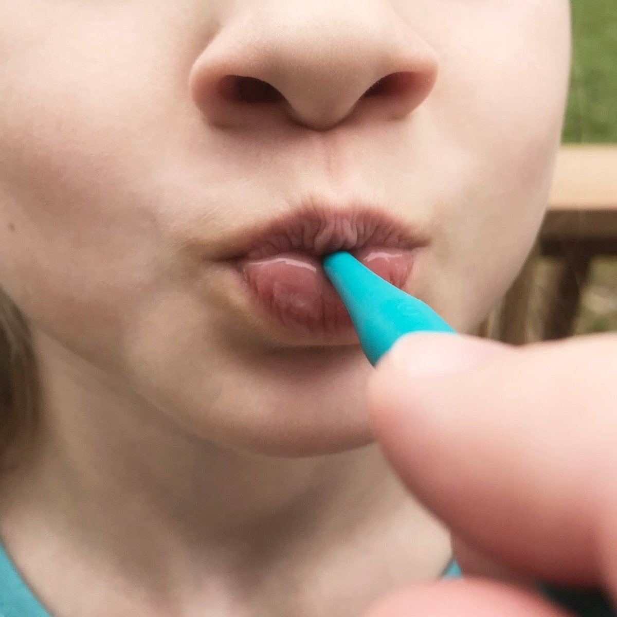 ARK's proButton™ for Lip Closure/Strength  ARK Therapeutic